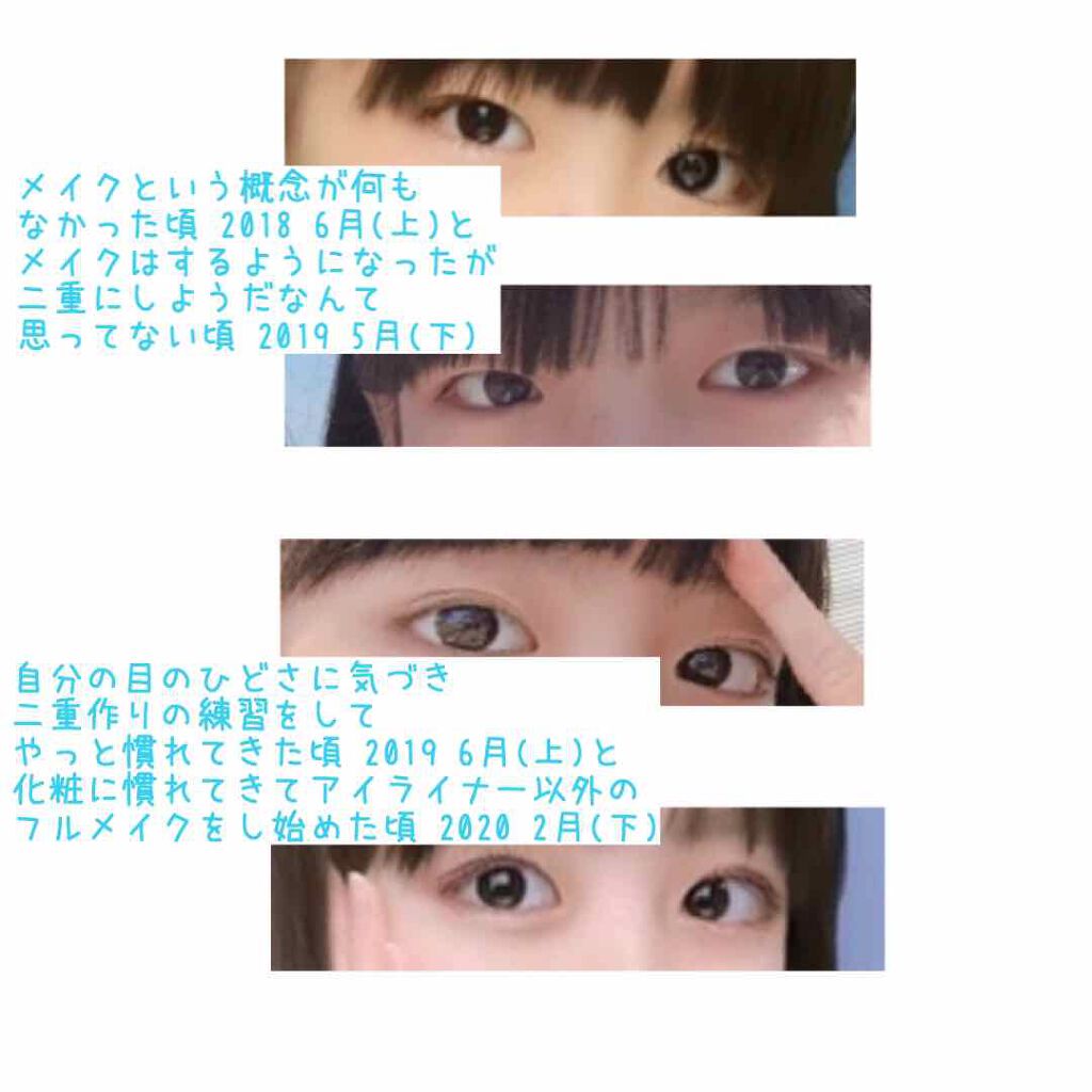 アイビューティー フィクサー WP/アストレア ヴィルゴ/二重まぶた用アイテムを使ったクチコミ（2枚目）