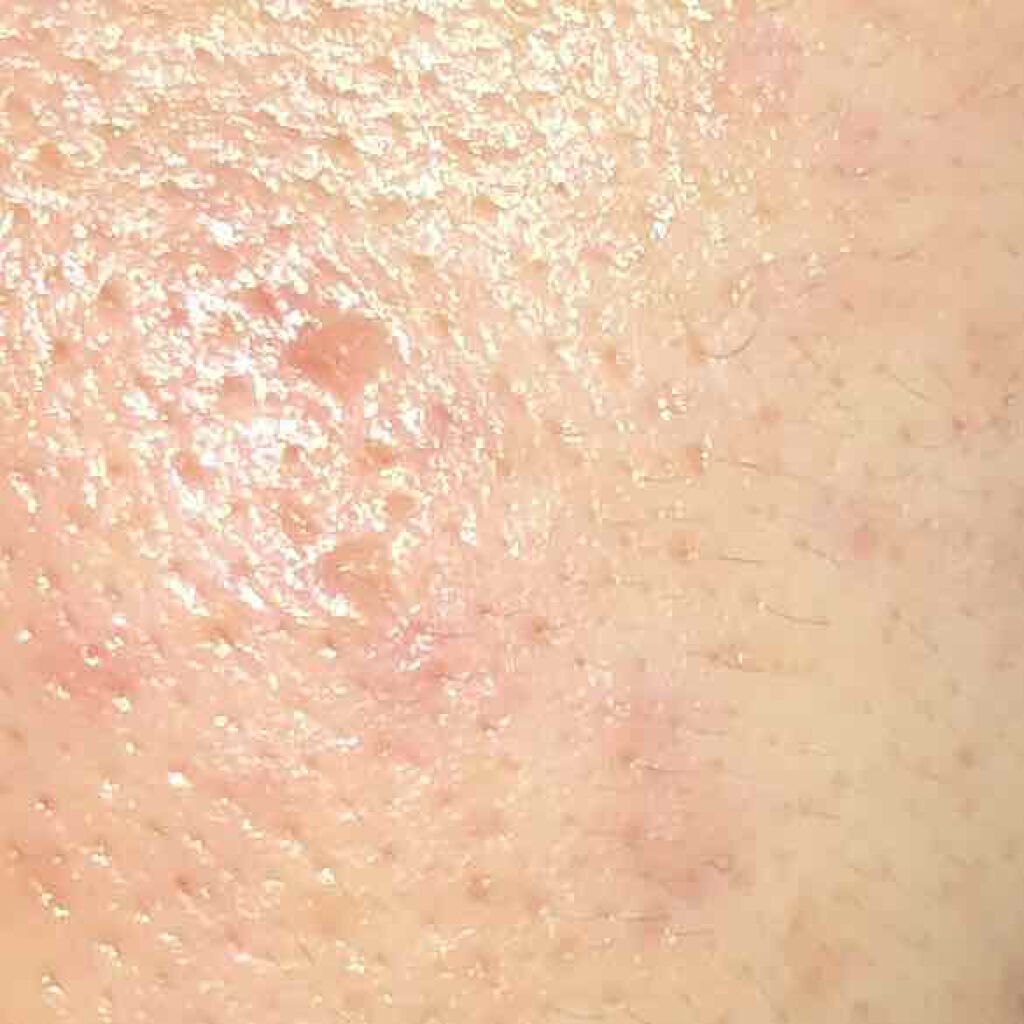 ジェルクリーム/ルナメアAC/フェイスクリームを使ったクチコミ（2枚目）