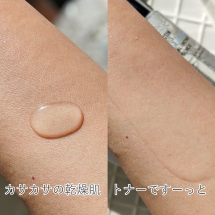 アクアヒアルロニックエッセンス/ロベクチン/化粧水を使ったクチコミ(5枚目)