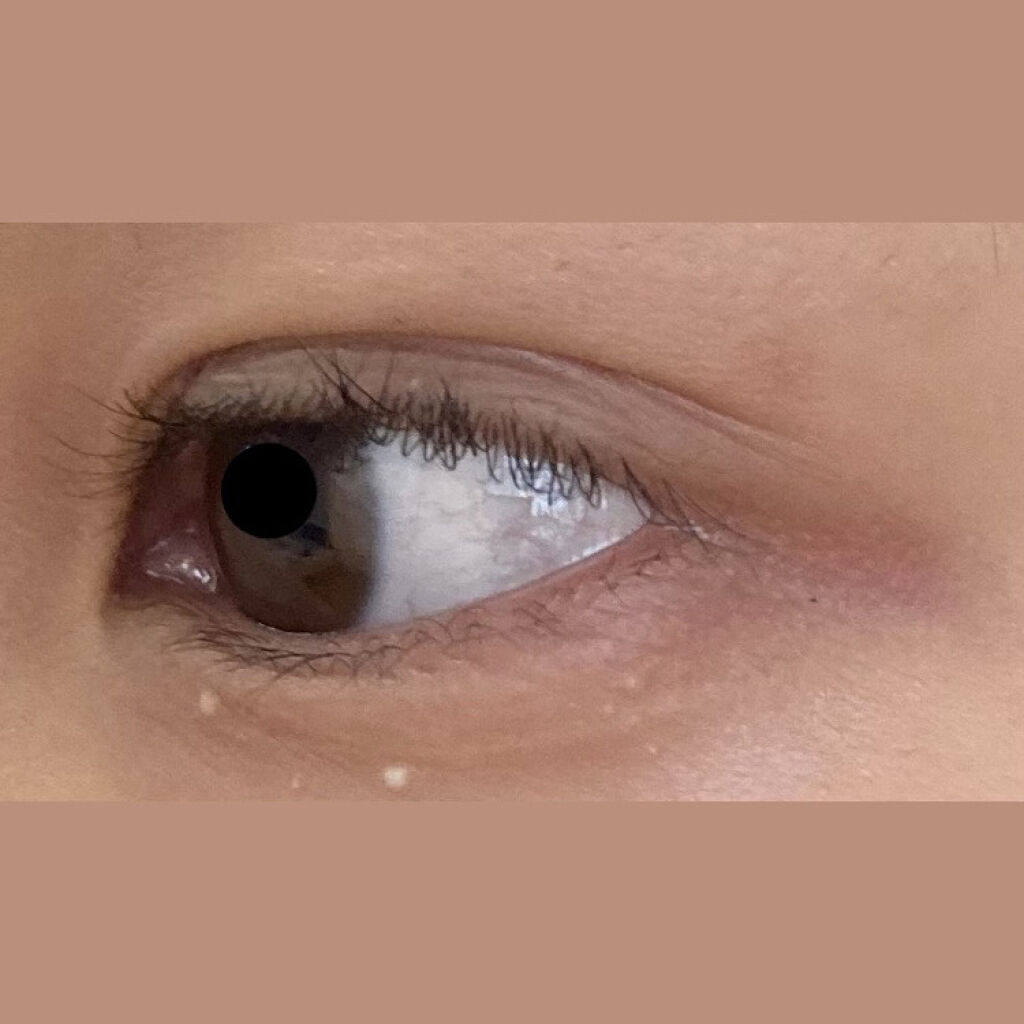 TWOOL ダブルアイリッドグルー/SHOBIDO/二重まぶた用アイテムを使ったクチコミ（3枚目）