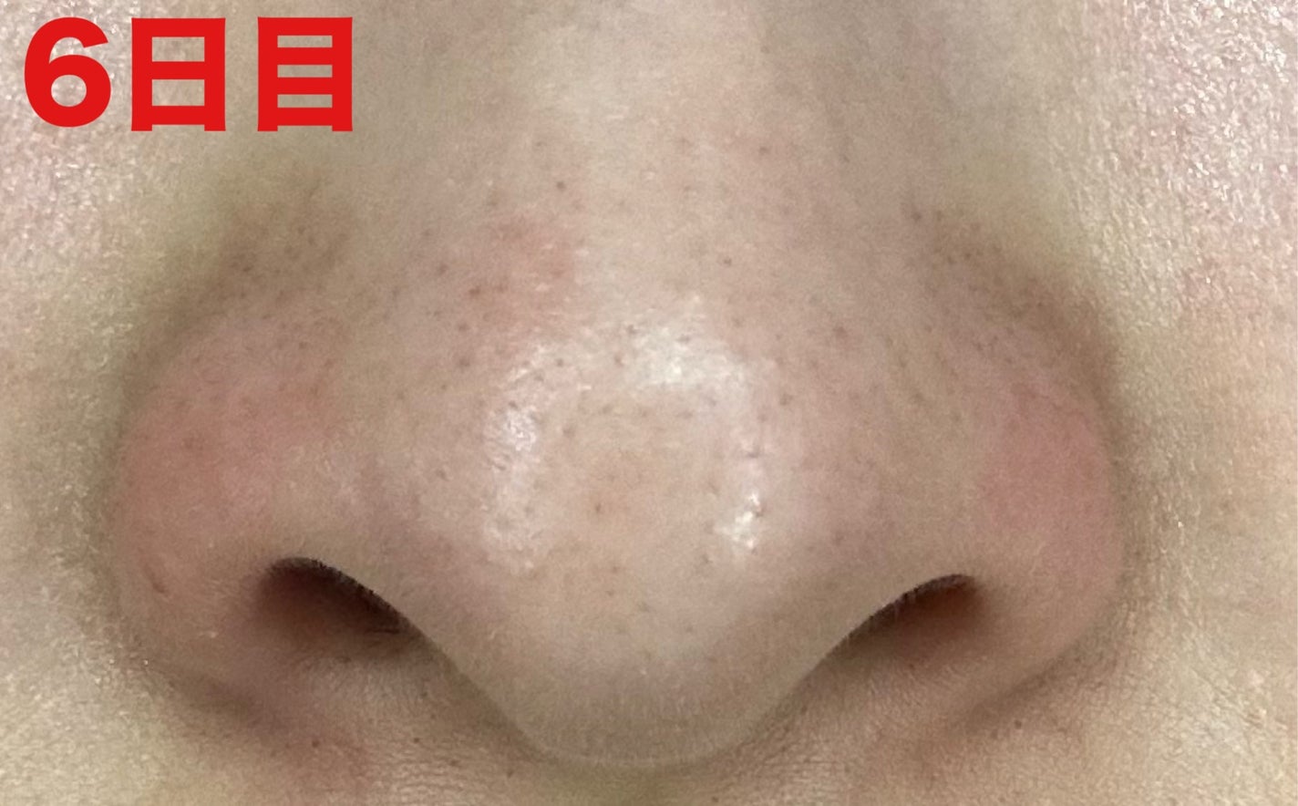 3番 緑茶炭毛穴パッククレンジングバーム/numbuzin/クレンジングバームを使ったクチコミ(2枚目)