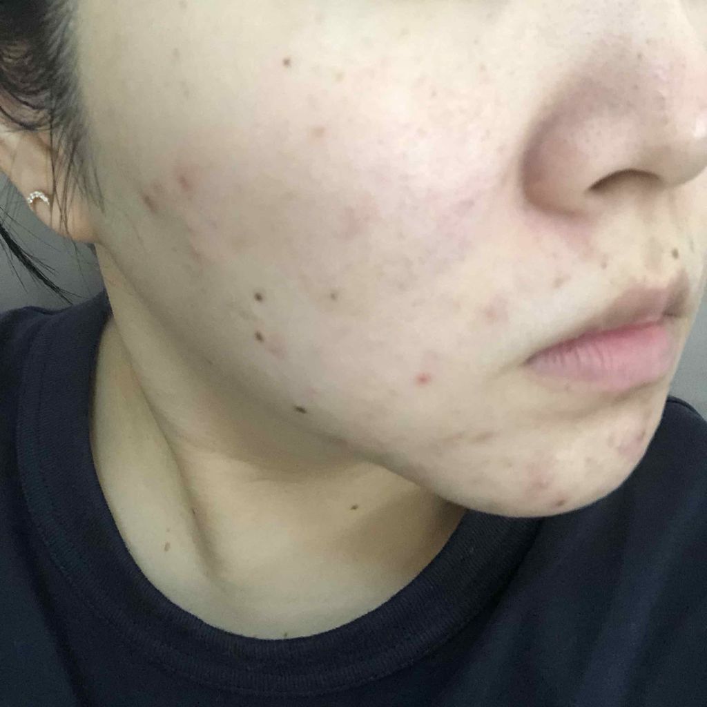 キールズ ハーバル トナー CL アルコールフリー/Kiehl's/化粧水を使ったクチコミ（2枚目）