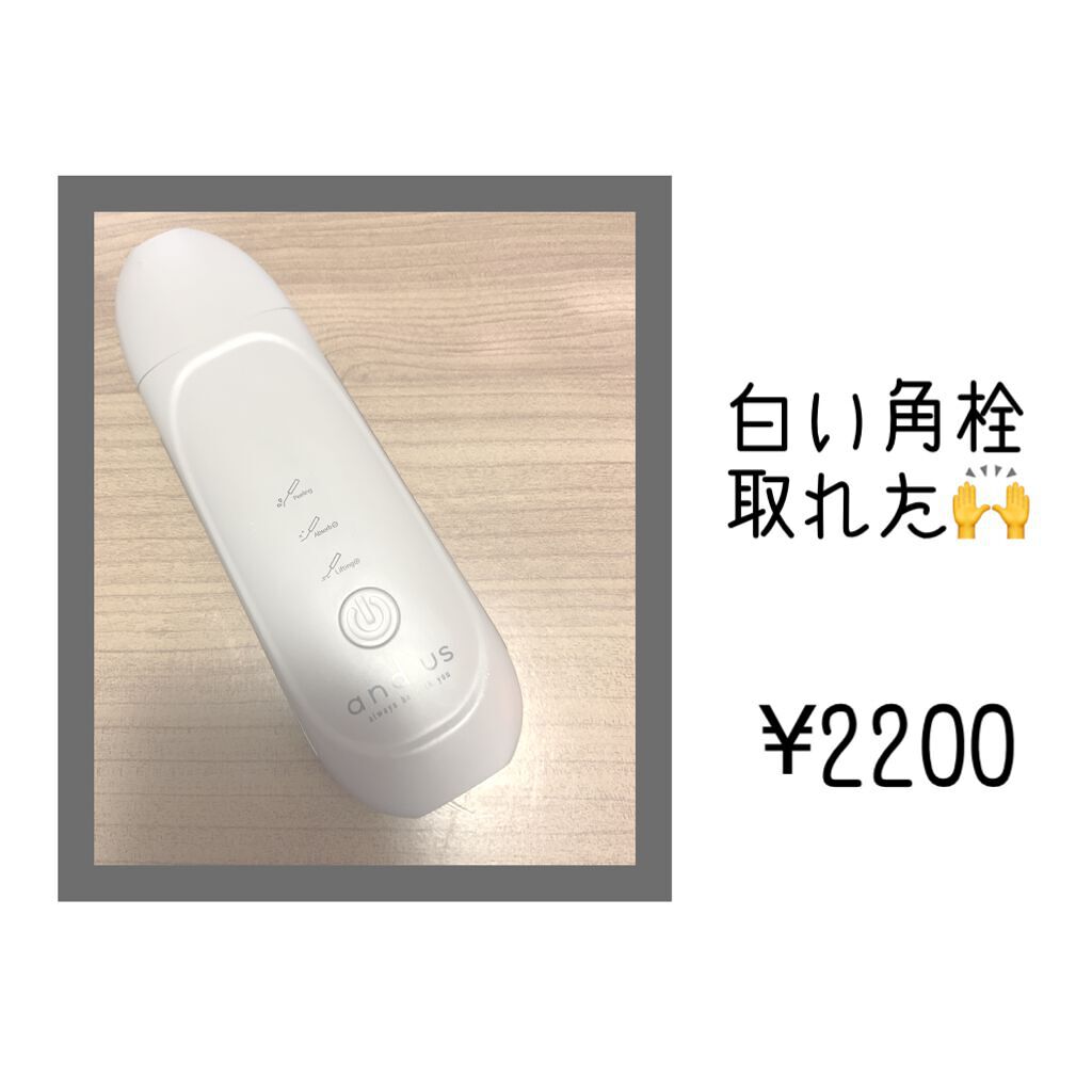 ウォーターピーラー and us