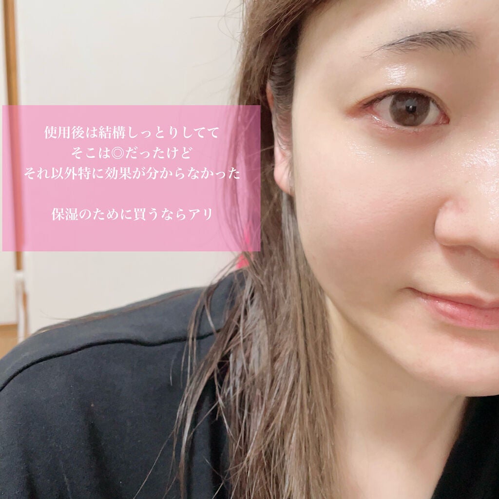 ごんす@YouTube始めました on LIPS 「《メディヒールパック》ドンキでお試しで買ったパック♪20代後半..」(4枚目)