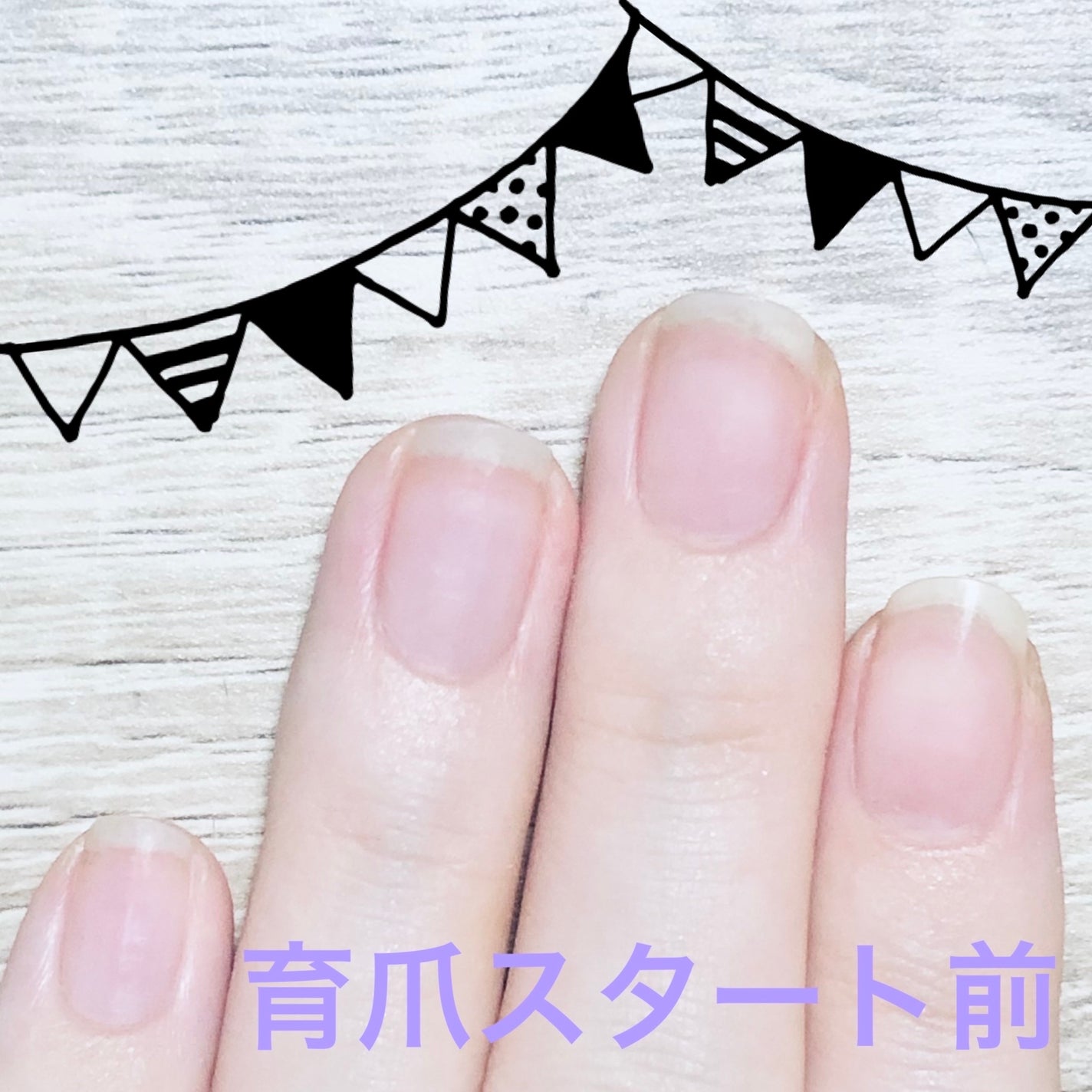 seina on LIPS 「7月末の状態毎日しっかりと保湿をして過ごしたらどのくらい爪は成..」(1枚目)