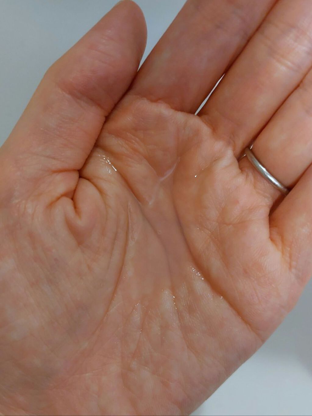 モイストエイジングケアローション/WHOMEE/化粧水を使ったクチコミ（2枚目）