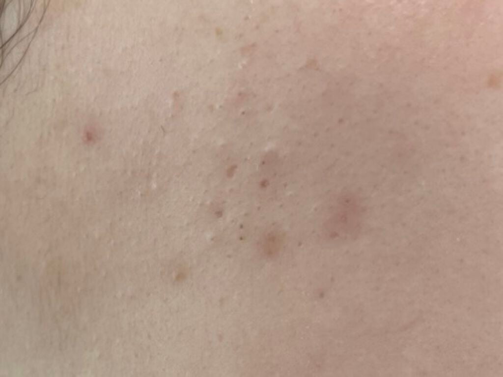 クリアフル ウォッシュ/オルビス/洗顔フォームを使ったクチコミ(5枚目)