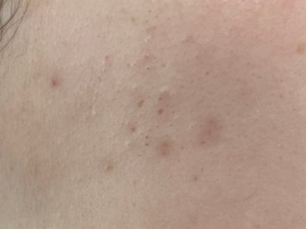 クリアフル ウォッシュ/オルビス/洗顔フォームを使ったクチコミ(5枚目)