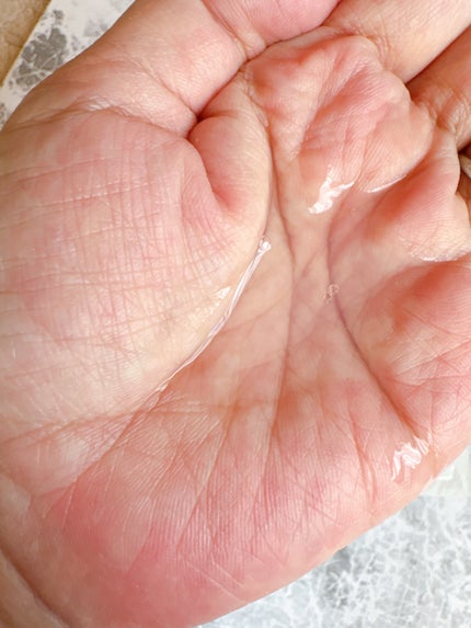 オイデルミン エッセンスローション/SHISEIDO/化粧水を使ったクチコミ(2枚目)