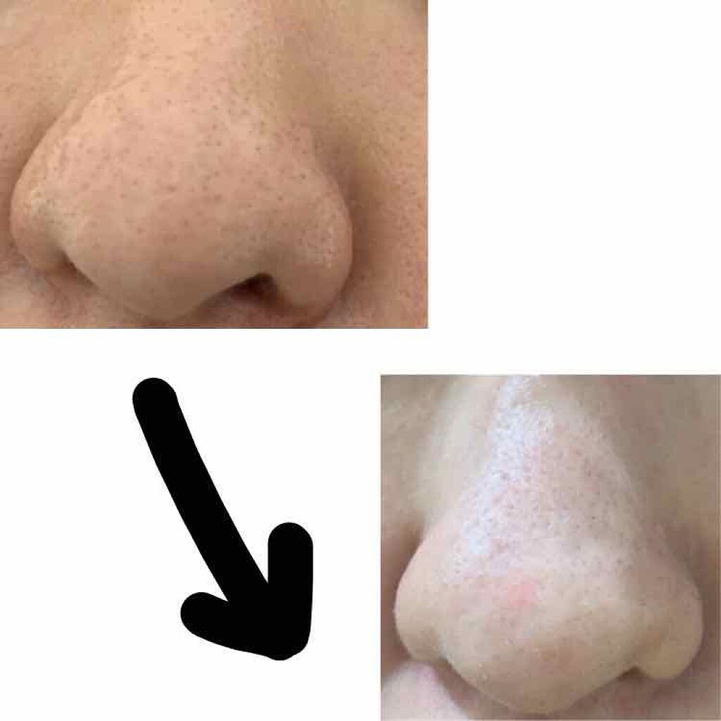 ロゼット 洗顔パスタ　荒性肌/ロゼット/洗顔フォームを使ったクチコミ（2枚目）