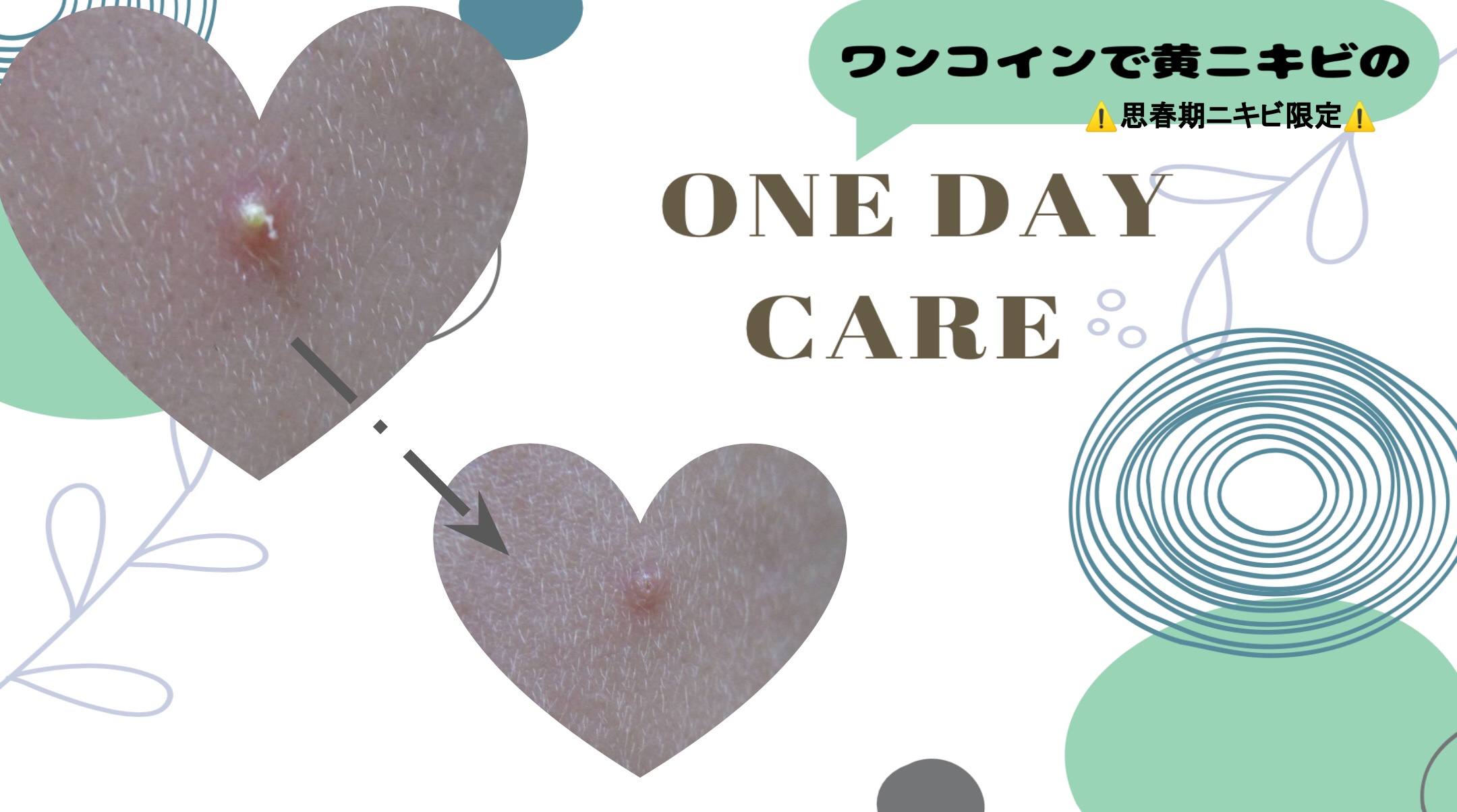 テラ・コートリル 軟膏(医薬品)/ジョンソン・エンド・ジョンソン/その他を使ったクチコミ（1枚目）