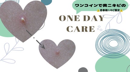 テラ・コートリル 軟膏(医薬品)/ジョンソン・エンド・ジョンソン/その他を使ったクチコミ(1枚目)