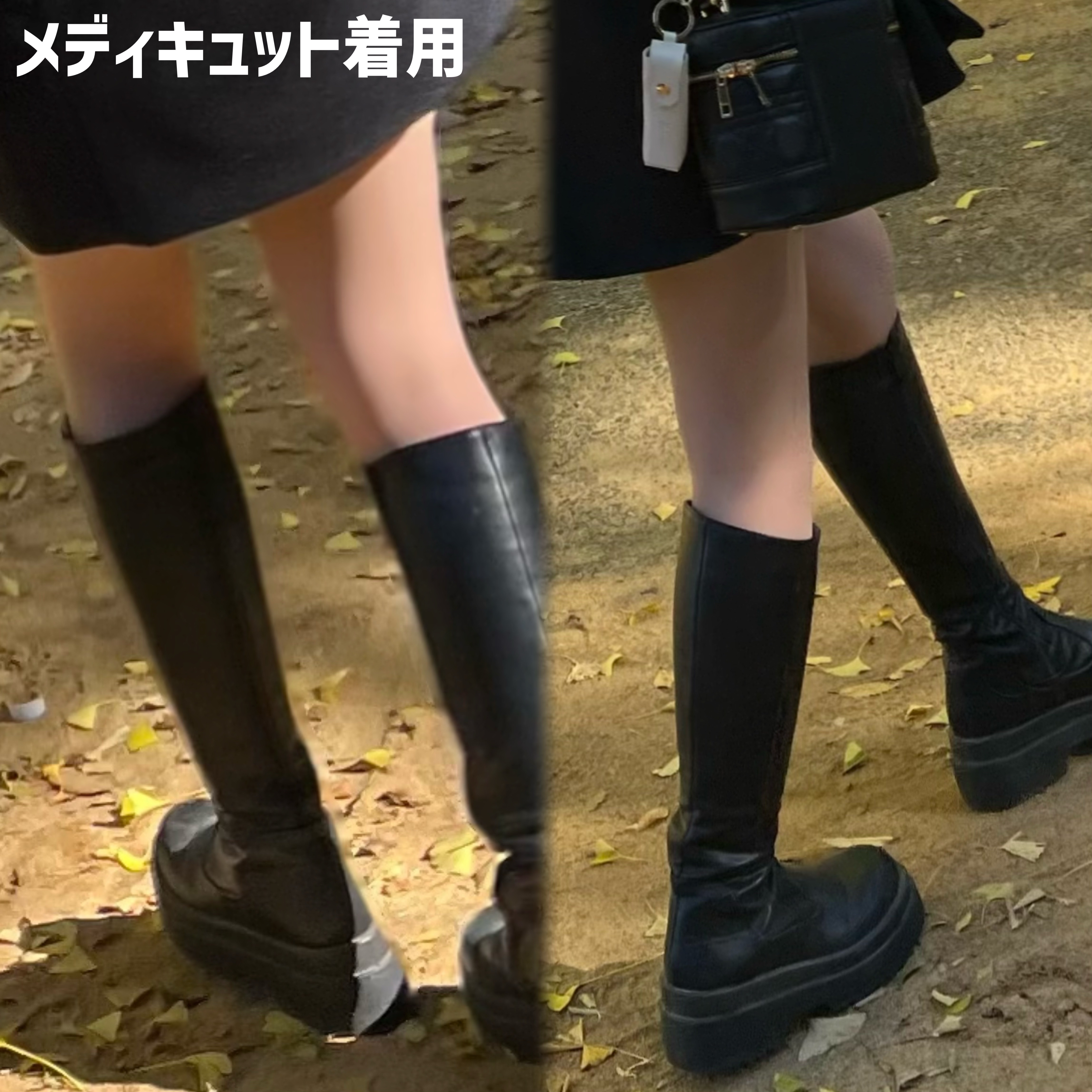 メディカル ストッキング/メディキュット/レッグ・フットケアを使ったクチコミ（3枚目）