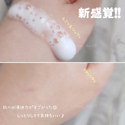 トップ シークレット ローション/YVES SAINT LAURENT BEAUTE/化粧水を使ったクチコミ(2枚目)