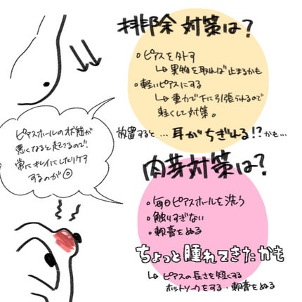 オキシドール(医薬品)/日本薬局方/その他を使ったクチコミ(9枚目)