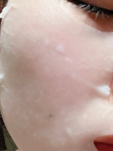 ごめんね素肌 キニナルマスク/クリアターン/シートマスク・パックを使ったクチコミ(5枚目)