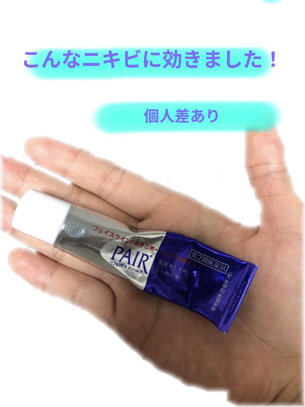 ペアアクネクリームW(医薬品)/ペア/その他を使ったクチコミ（1枚目）