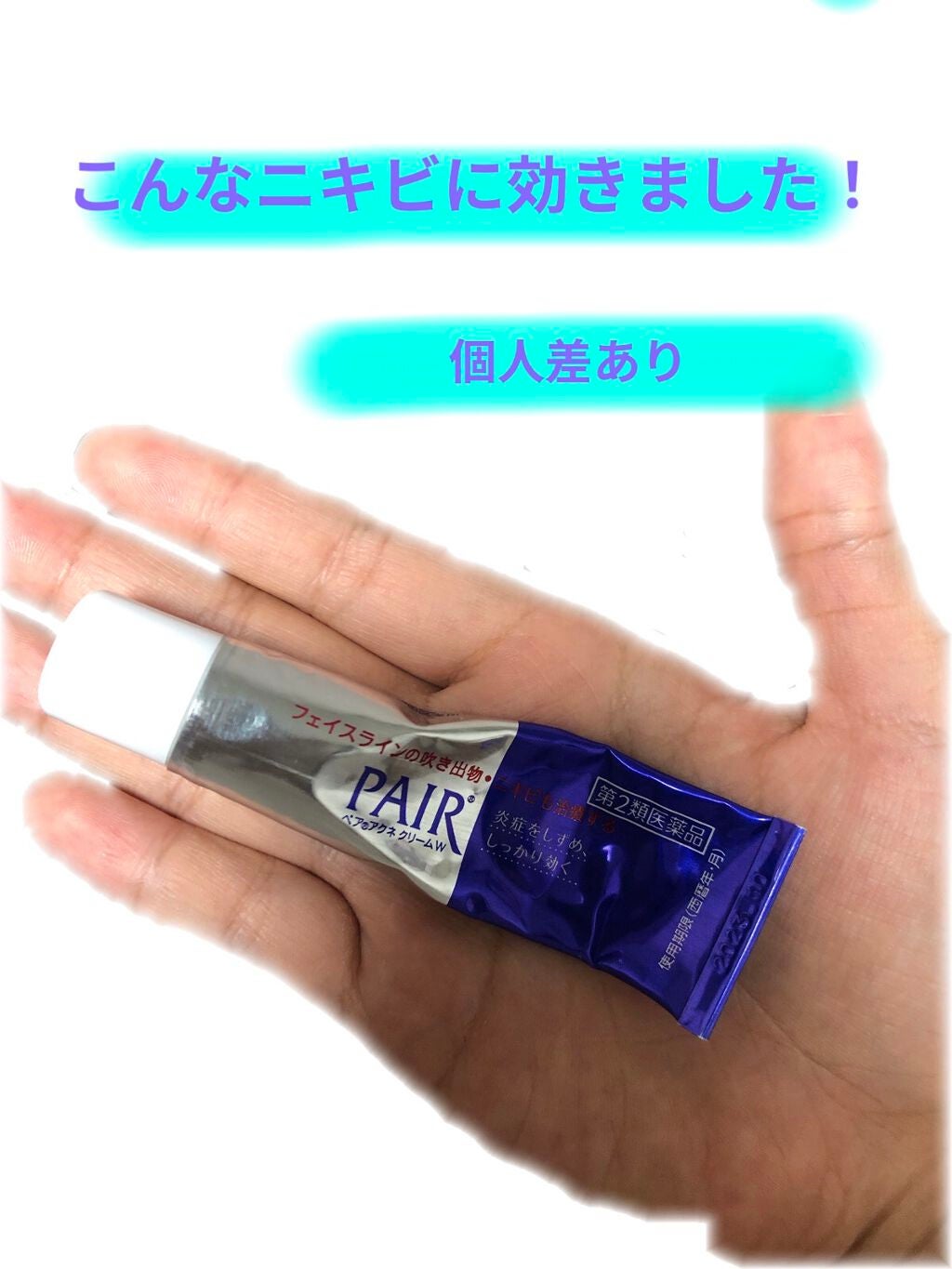 ペアアクネクリームW(医薬品)/ペア/その他を使ったクチコミ(1枚目)