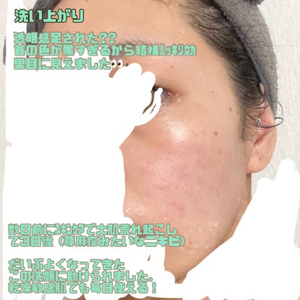 コーラルクリア パウダーウォッシュ/アルファピニ28/洗顔パウダーを使ったクチコミ(4枚目)