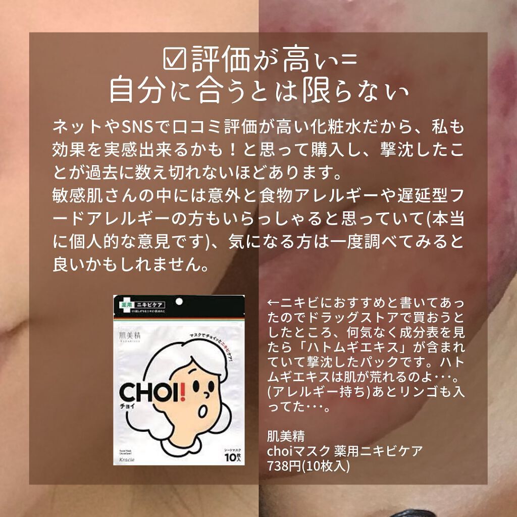 ガスール固形/ナイアード/洗顔石鹸を使ったクチコミ(5枚目)