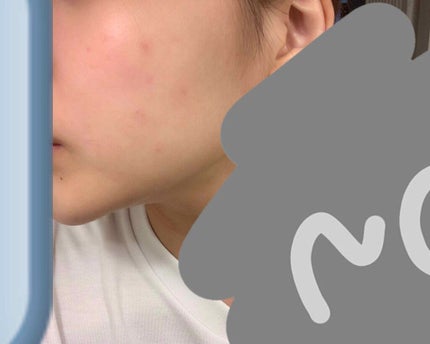 ♛Riri♛ on LIPS 「こんにちわ°♡°今回はずっーと私が悩んでいる事をお話したいと思..」(2枚目)