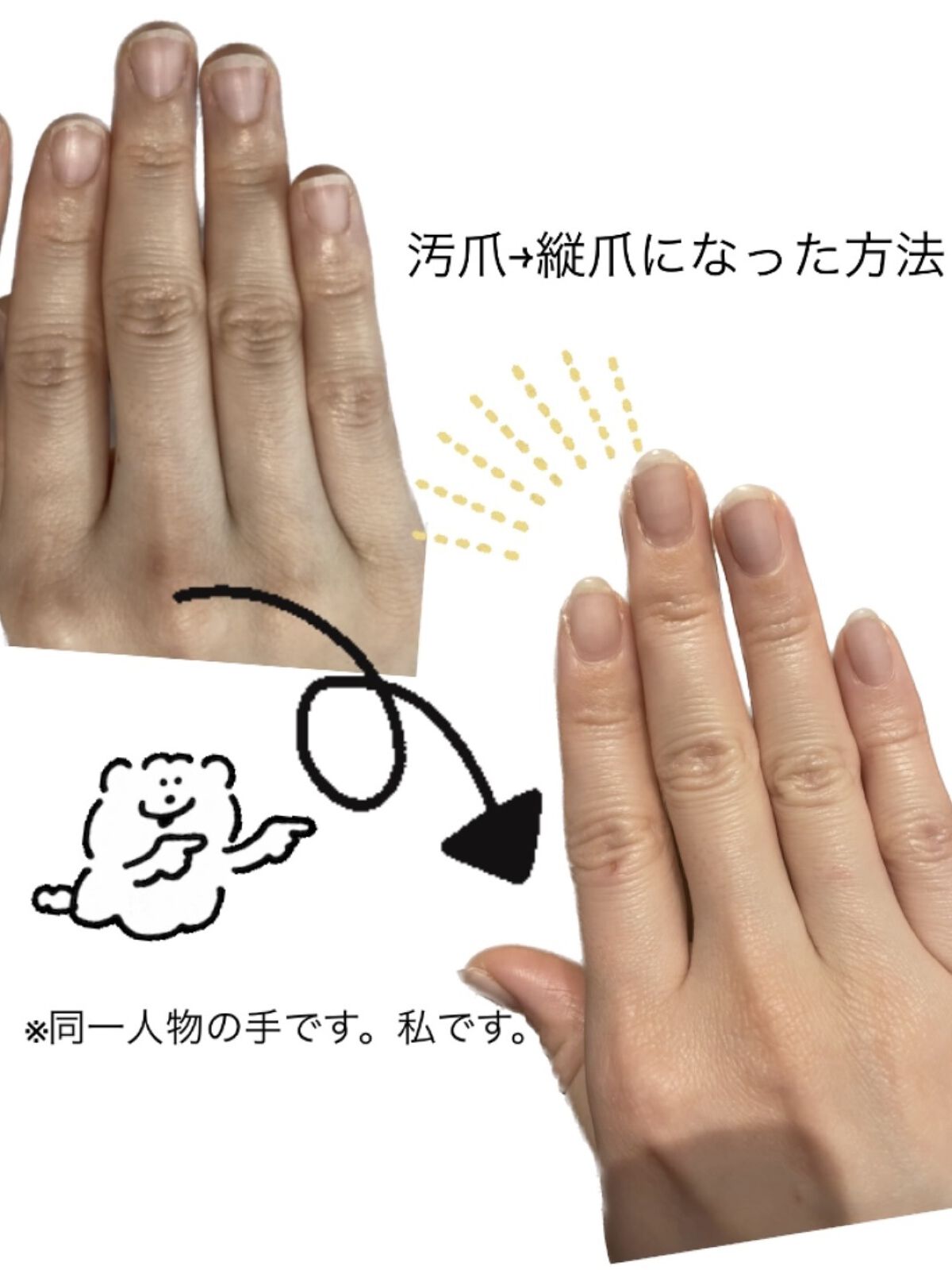 ネイルケアオイル/無印良品/ネイルオイル・トリートメントを使ったクチコミ（1枚目）