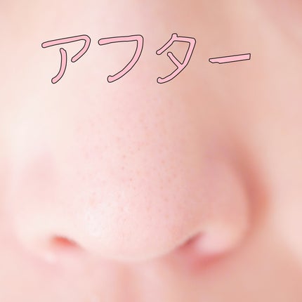 ダブルショットLHA毛穴ケアクレンジングフォーム /LUOKI/クレンジングクリームを使ったクチコミ(5枚目)