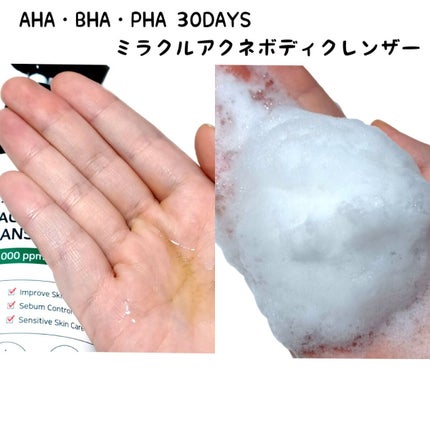 AHA.BHA.PHAミラクルカーミングボディローション /SOME BY MI/ボディローションを使ったクチコミ(2枚目)