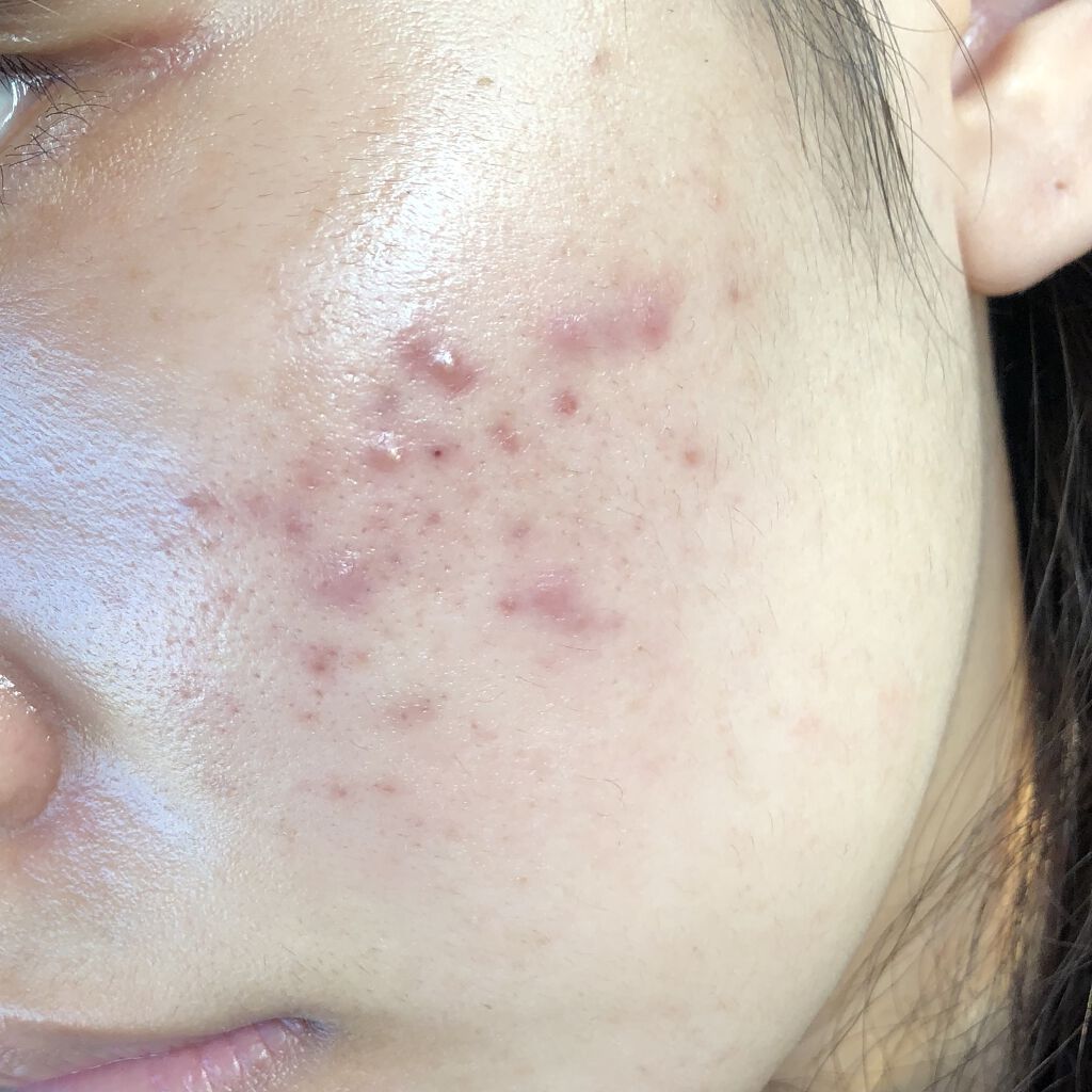 デュオ ザ 薬用クレンジングバーム バリア【医薬部外品】/DUO/クレンジングバームを使ったクチコミ（2枚目）