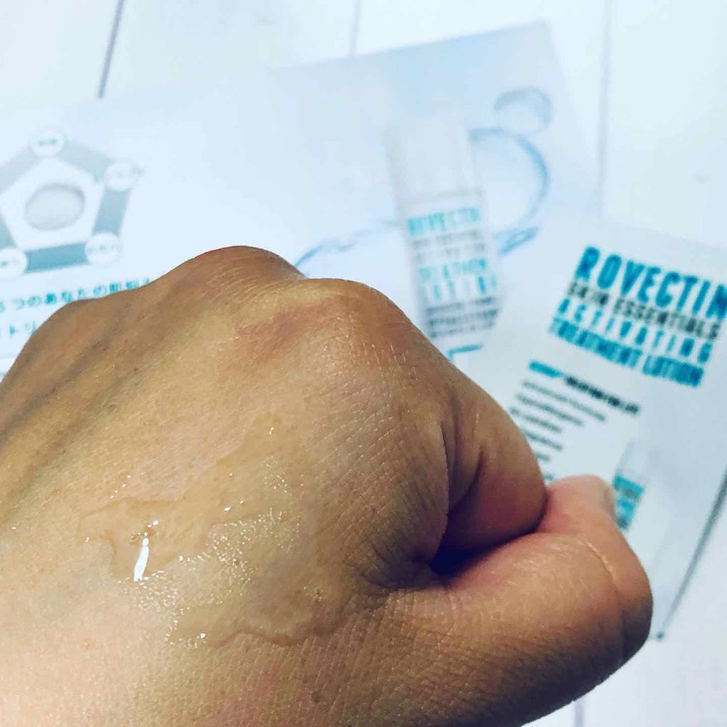 エッセンシャル トリートメントローション/ロベクチン/化粧水を使ったクチコミ（2枚目）