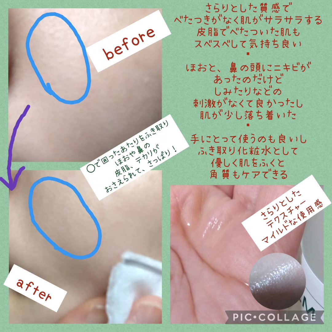 バリアサイクルトナー/P.CALM/化粧水を使ったクチコミ（3枚目）