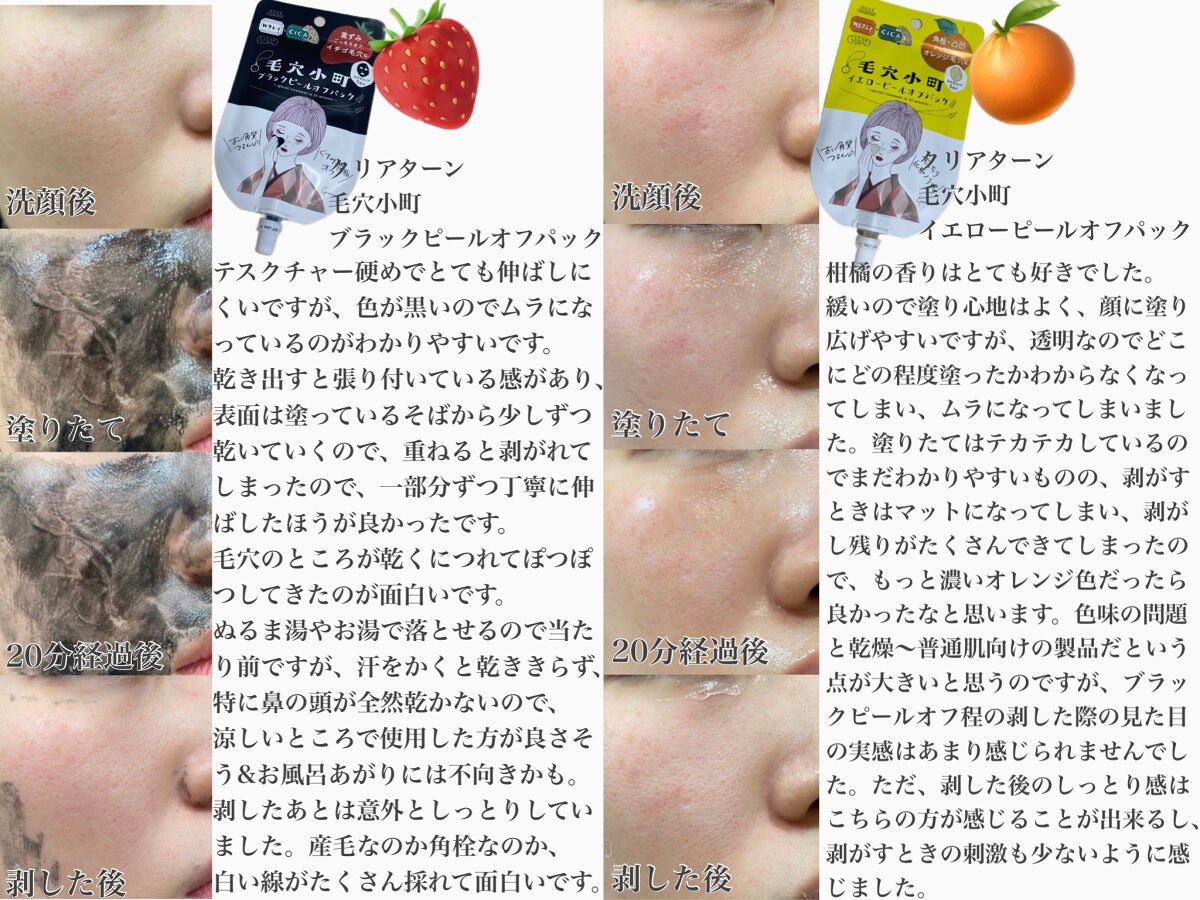 毛穴小町マスク /クリアターン/シートマスク・パックを使ったクチコミ(3枚目)