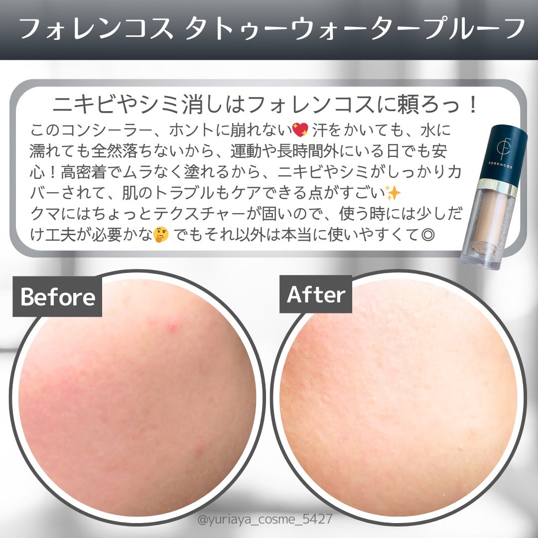 タトゥーウォータープルーフスカーコンシーラー/フォレンコス/リキッドコンシーラーを使ったクチコミ(2枚目)