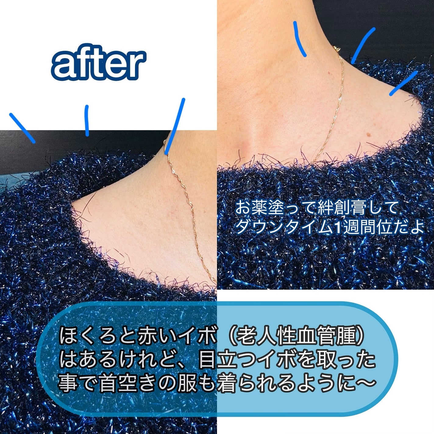 グラスティングカラーグロス/rom&nd/リップグロスを使ったクチコミ(4枚目)