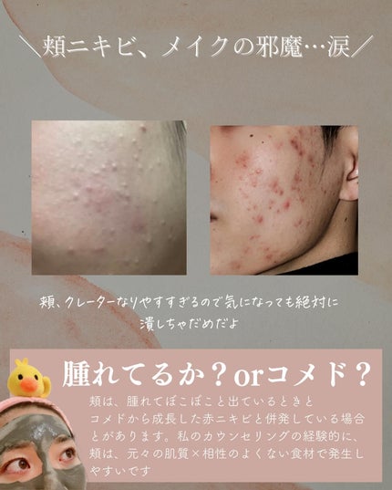 を使ったクチコミ(2枚目)