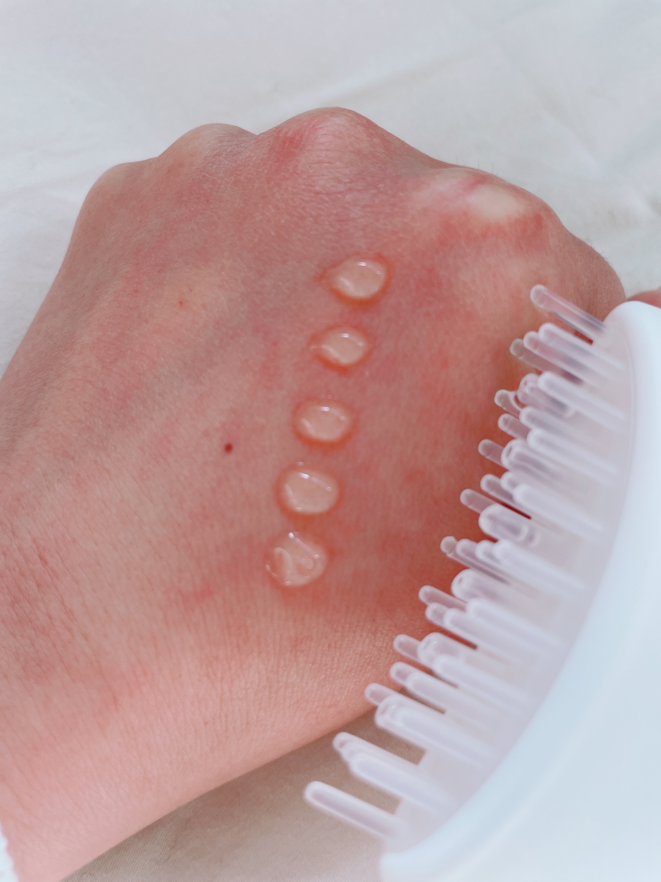 グローターン 100ml/リリーイブ/頭皮ローションを使ったクチコミ（2枚目）