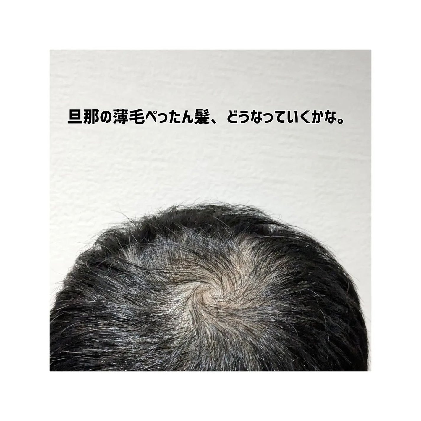 SonoRepro/アンファー(スカルプD)/ヘアケアグッズを使ったクチコミ(4枚目)