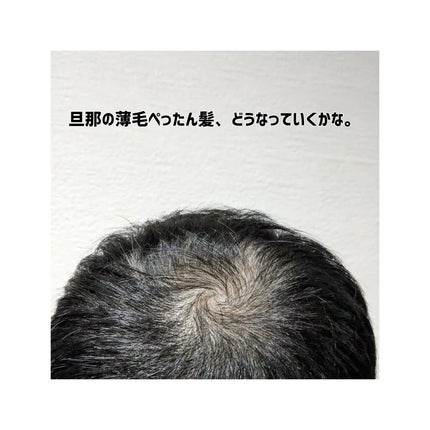 SonoRepro/アンファー(スカルプD)/ヘアケアグッズを使ったクチコミ(4枚目)