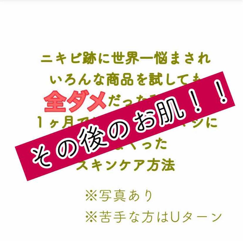 薬用しみ対策 美白化粧水 しっとりタイプ/メラノCC/化粧水を使ったクチコミ（1枚目）