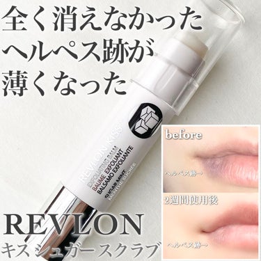 レブロン キス シュガー スクラブ/REVLON/リップスクラブを使ったクチコミ（1枚目）