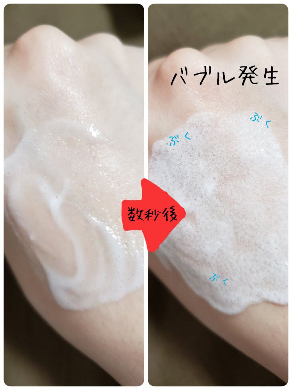 MILK BUBBLE ESSENCE PACK ＃PLAIN/G9SKIN/美容液を使ったクチコミ（2枚目）