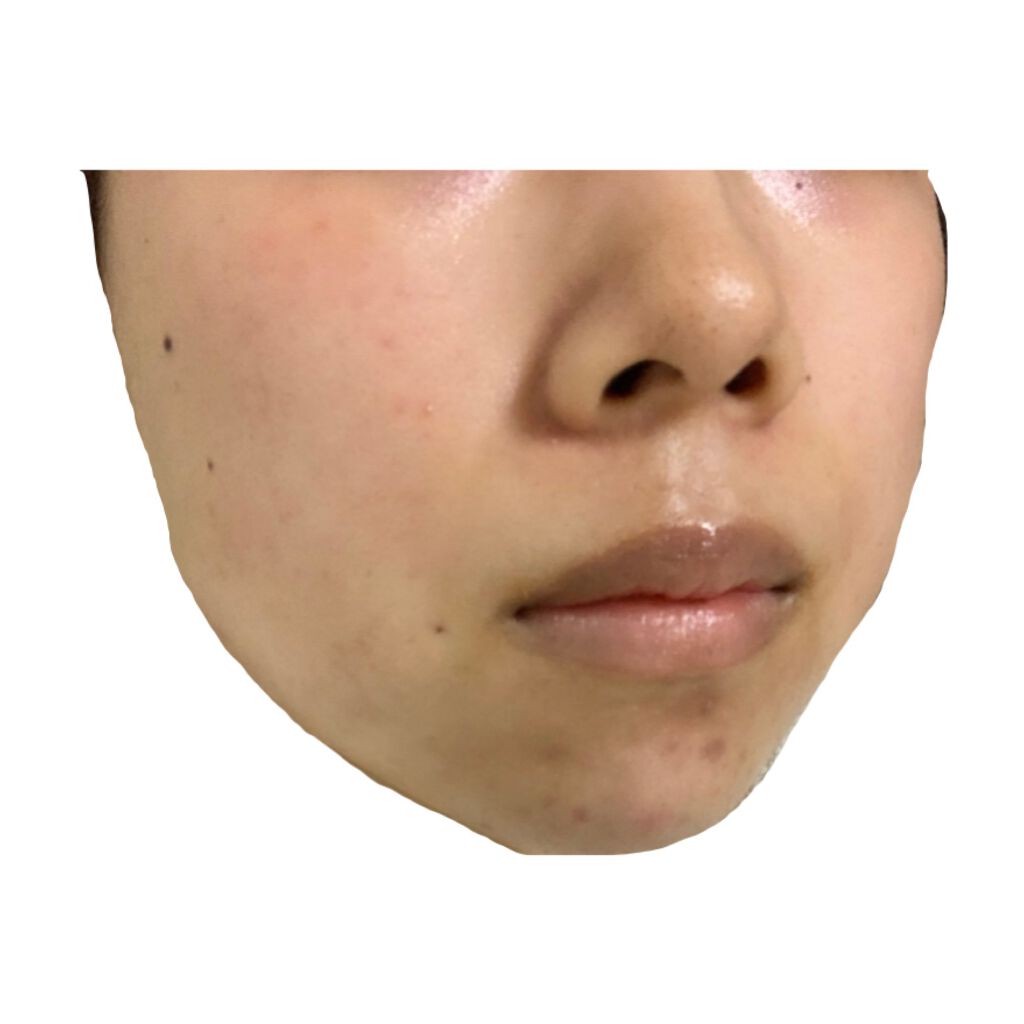 白色ワセリン(医薬品)/健栄製薬/その他を使ったクチコミ（1枚目）