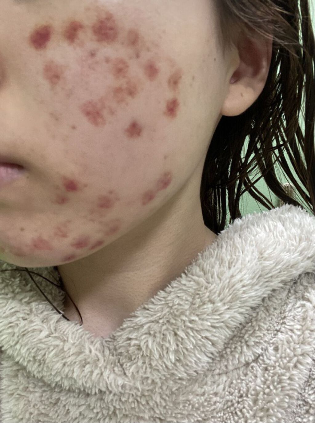 チョコラBBプラス (医薬品)/チョコラBB/その他を使ったクチコミ（3枚目）