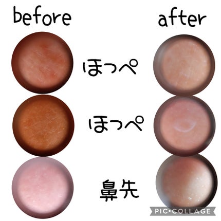 リードルショット100/VT/美容液を使ったクチコミ(6枚目)