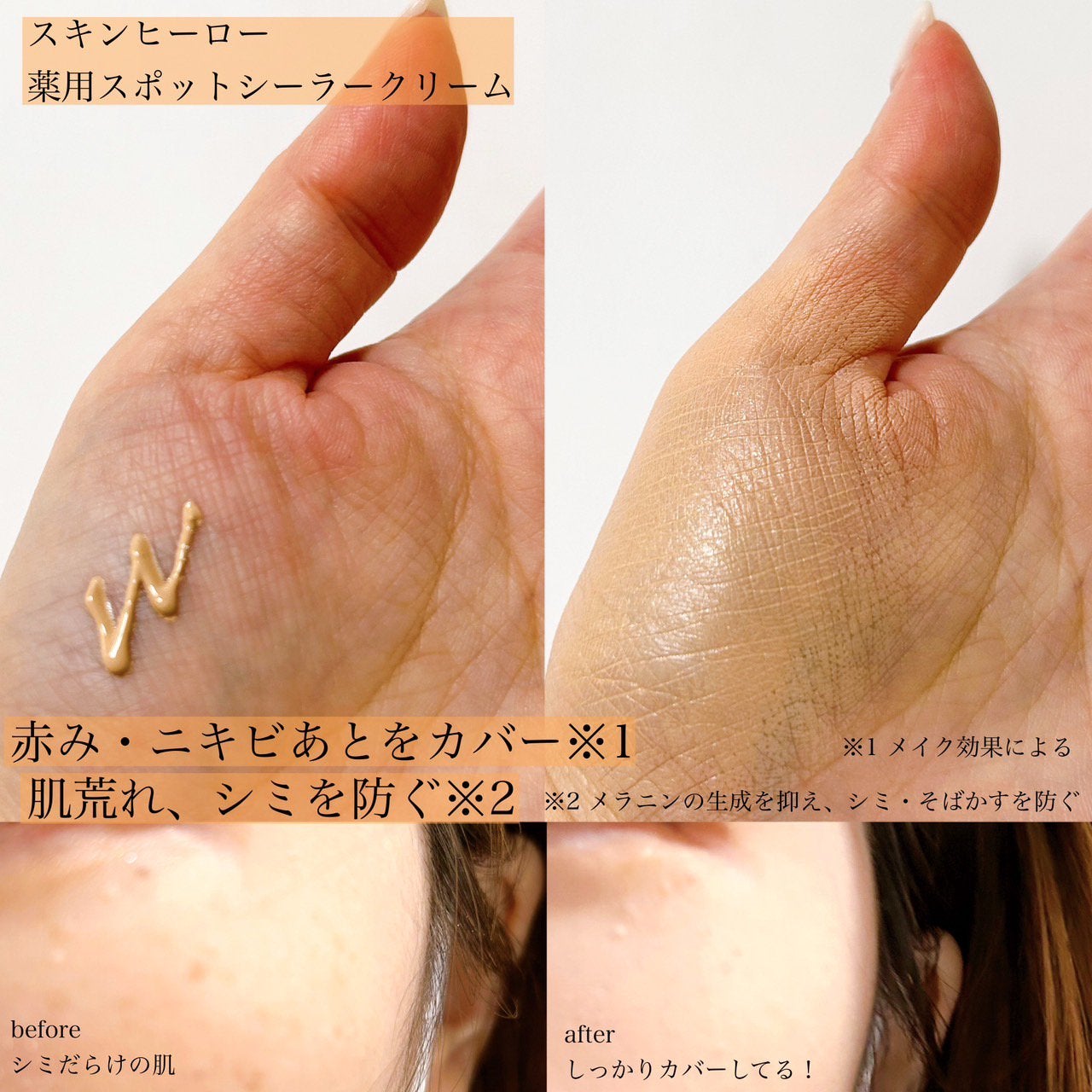 薬用スポットシーラークリーム/スキンヒーロー/クリームコンシーラーを使ったクチコミ(2枚目)