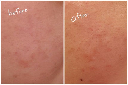 美容クリーム/はしかた化粧品/フェイスクリームを使ったクチコミ(3枚目)