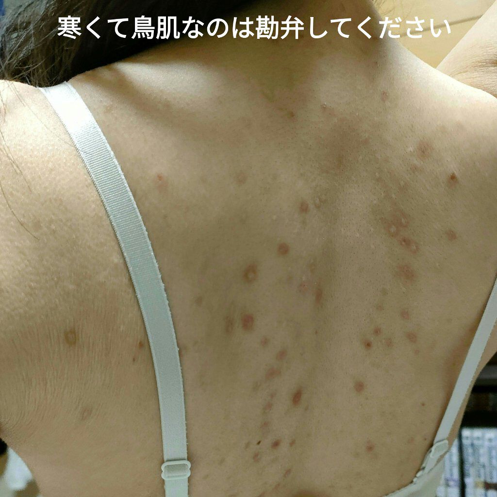 DHC ビタミンBミックス/DHC/美容サプリメントを使ったクチコミ（2枚目）