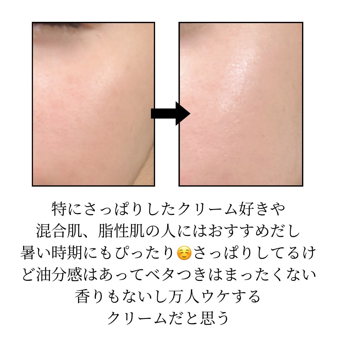 アクアスクワランモイスチャークリーム/S.NATURE/フェイスクリームを使ったクチコミ(4枚目)