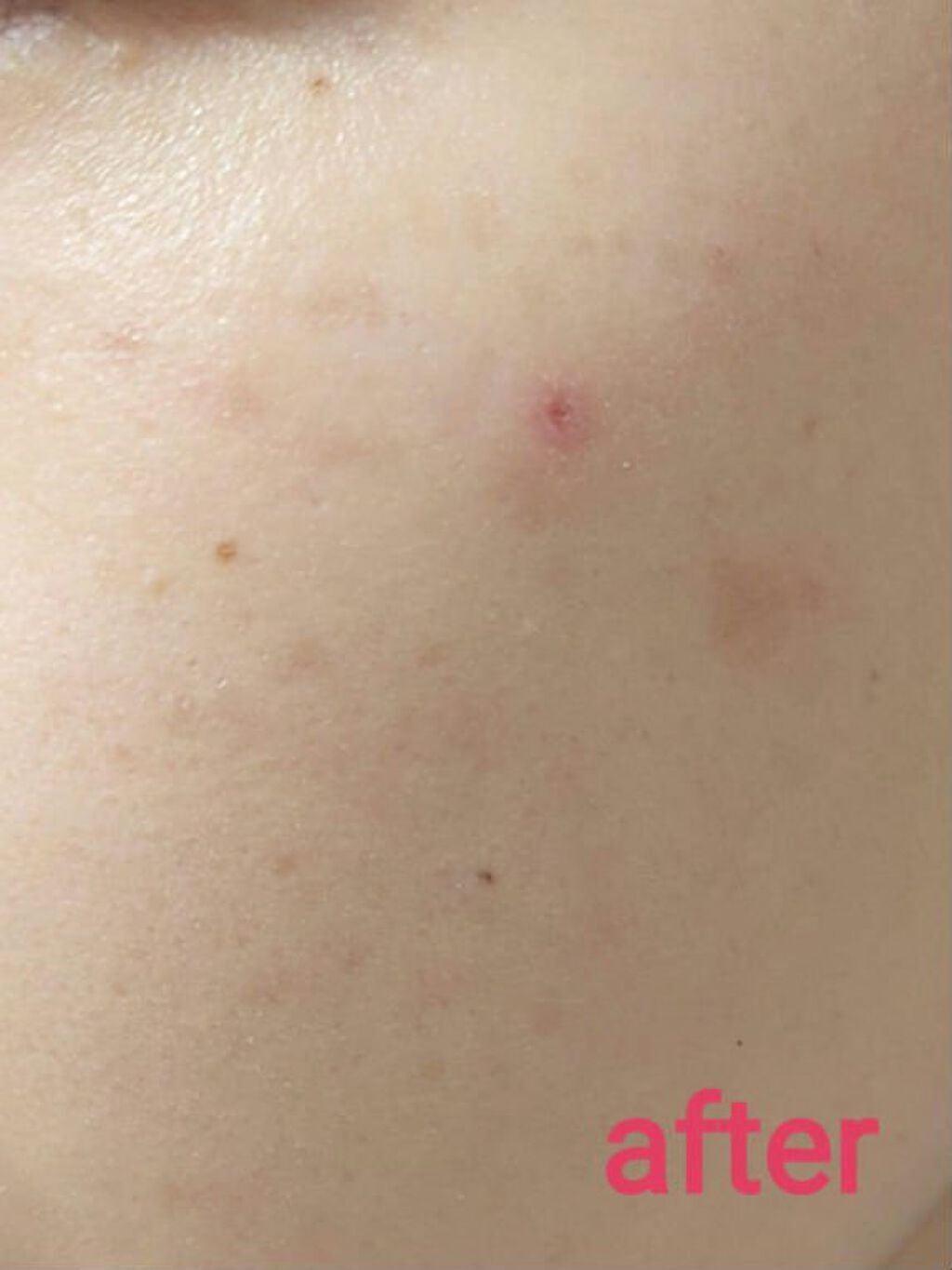 UVイデア XL プロテクショントーンアップ ローズ/ラ ロッシュ ポゼ/日焼け止めクリームを使ったクチコミ(4枚目)