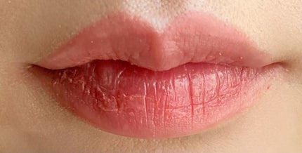 ãã¬ã€ã«ã©ãŒ ã¢ã€ã·ã£ããŠ/ETUDE/ã¢ã€ã·ã£ããŠãã¬ããã䜿ã£ãã¯ãã³ãïŒ6æç®ïŒ